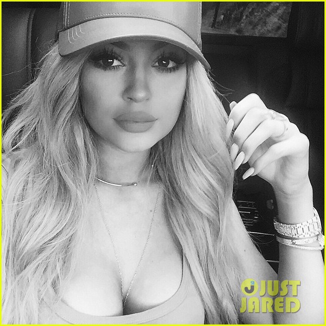 kylie jenner praises surgeon who injects lips 03