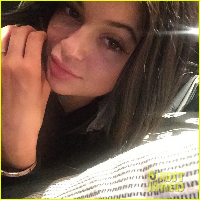 kylie jenner praises surgeon who injects lips 09