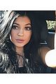 kylie jenner praises surgeon who injects lips 13