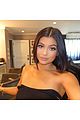 kylie jenner praises surgeon who injects lips 17