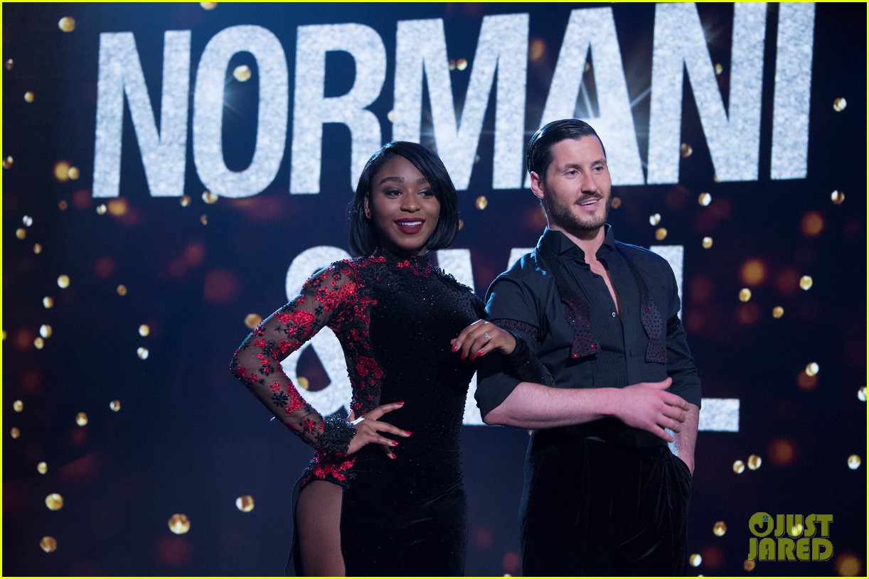 exlcusive normani kordeis dwts injury is way worse than we thought 01