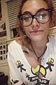 paris jackson opens up about her surgery for abscess almost the size of a golf ball 01