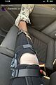 noah centineo knee surgery update 03