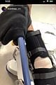 noah centineo knee surgery update 09