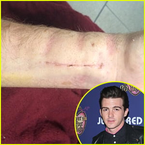 Drake Bell Shatters Wrist & May Never Play Guitar Again