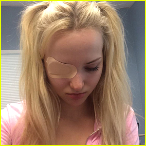 Dove Cameron Scratches Her Eye After Scoring Teen Choice Award Nomination