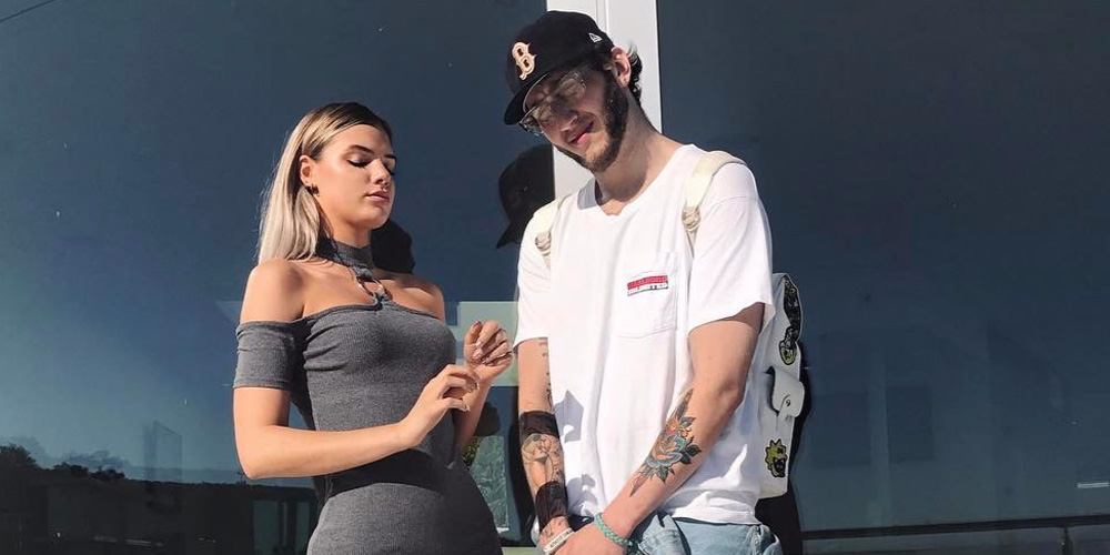 Alissa Violet Shows Off Bruises After Reportedly Getting Into Fight at Bar