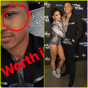 Tinashe Gave Brandon Armstrong A Black Eye After Their Stunning Argentine Tango on 'DWTS'