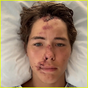 TikToker Caleb Coffee Shares Update After Falling Off a Cliff During a Hike with Friends